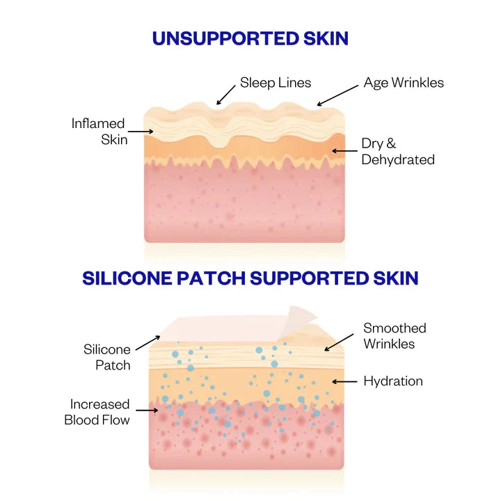 Wrinkles Schminkles Patches