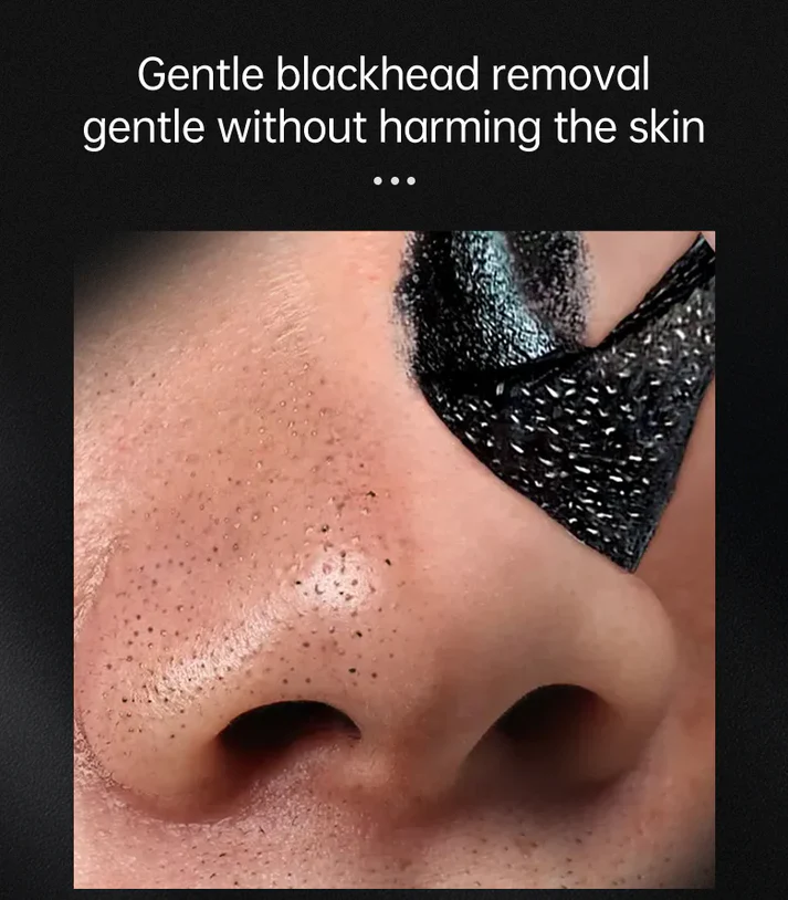 Blackhead Peeling Mask™