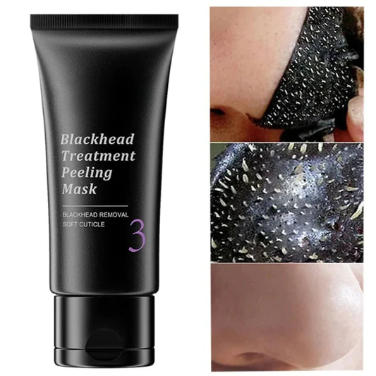 Blackhead Peeling Mask™