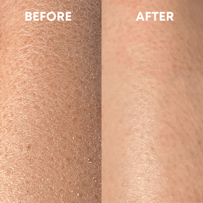 Side-by-side comparison of skin showing results before and after treatment with the CheekyGlo Exfoliating Glove. The left side labeled "BEFORE" displays dry, flaky skin, while the right side labeled "AFTER" showcases smoother, hydrated skin treated by CheekyGlo.