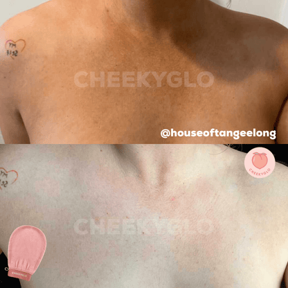 Two side-by-side photos of a person's upper chest and shoulder area, showcasing a before and after comparison of using the CheekyGlo Exfoliating Glove by CheekyGlo. The “before” image shows some redness, while the “after” image reveals healthier, smoother skin. The CheekyGlo Exfoliating Glove is featured in the bottom corner.