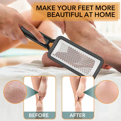 STAINLESS STEEL CALLUS REMOVER