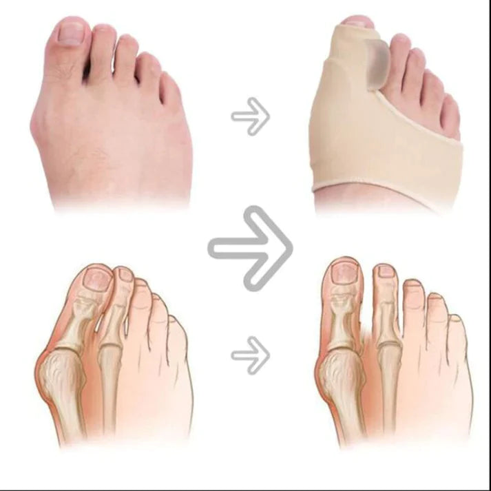 Orthopedic Bunion Corrector Socks™