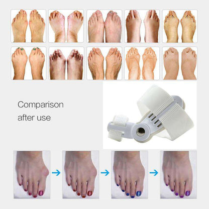 ORTHOPEDIC BUNION CORRECTOR